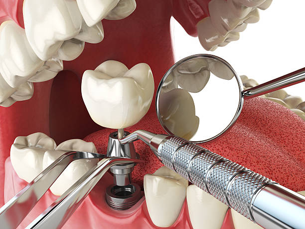 Best 24-Hour Emergency Dental Care in Moundridge, KS